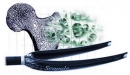 Tuningov� SCOTT �iletka a kosti od THM Carbones