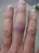 J� kopyto a J�grova prysky�ice